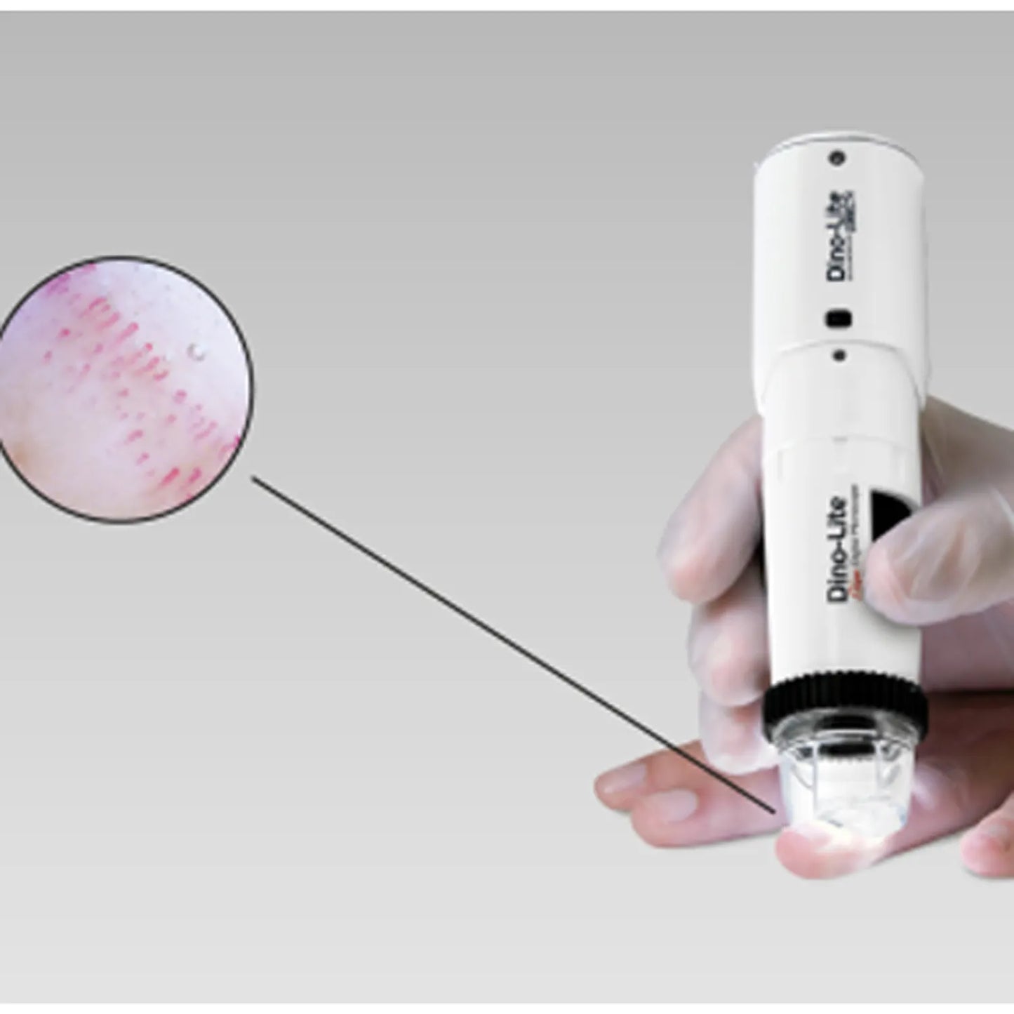 CapillaryScope 500 Pro (kabellos)