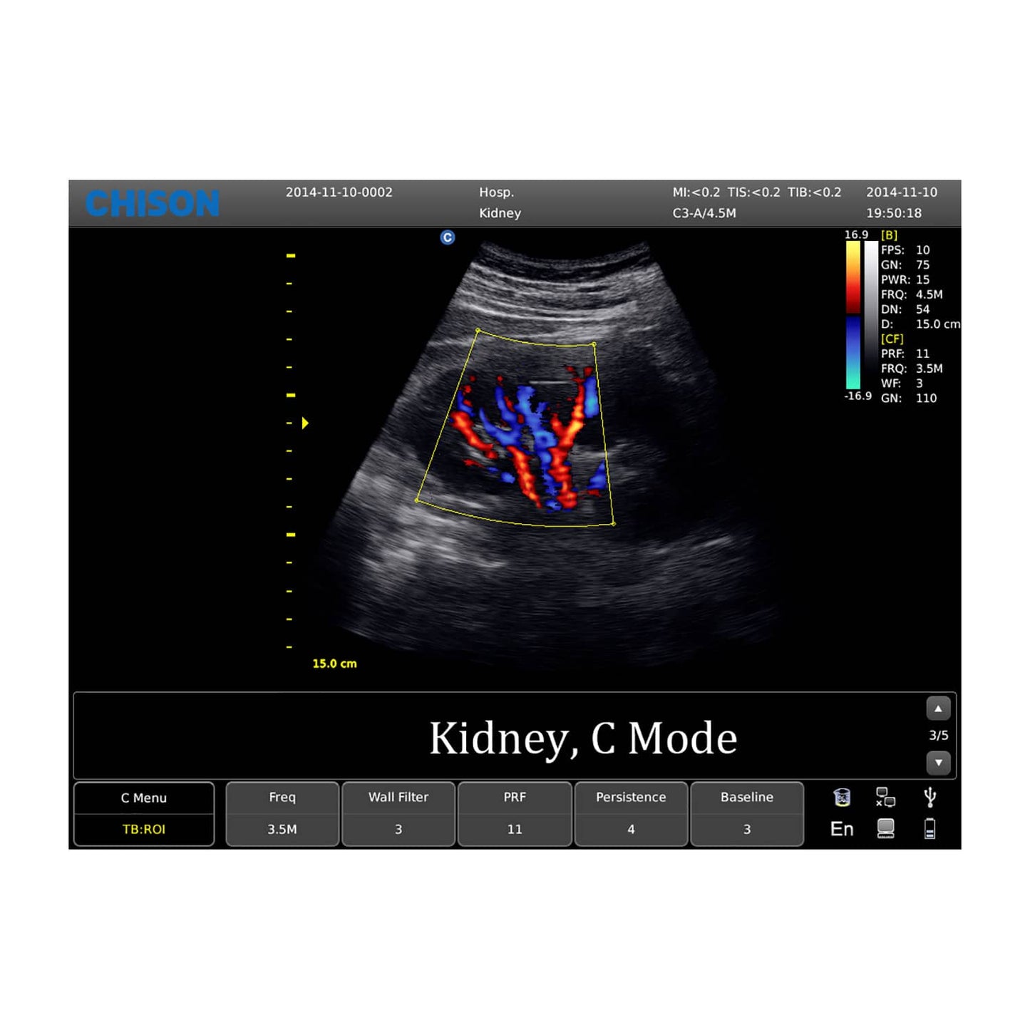 CHISON ECO5 mobiles Diagnosegerät - Vielseitige Anwendung in verschiedenen Fachbereichen - Med-Praxisbedarf