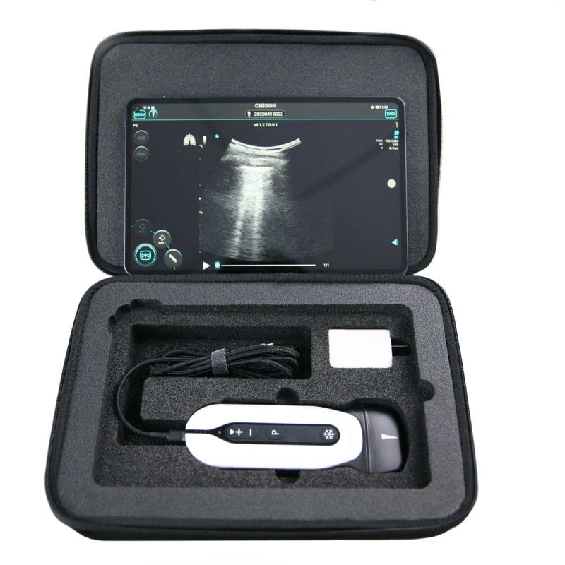 Transportkoffer für Chison SonoEye - schützt Ultraschall-Handgerät und Zubehör - Med-Praxisbedarf