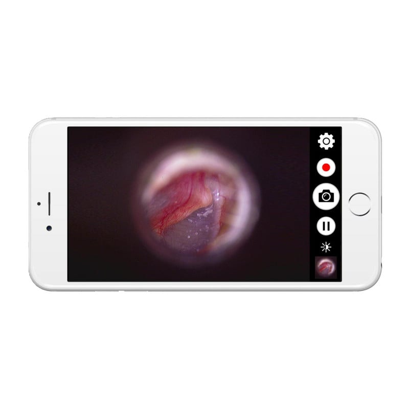 HD-Endoskop Firefly DE 1270 - digitale Kamera für präzise Diagnostik in der Praxis - Med-Praxisbedarf