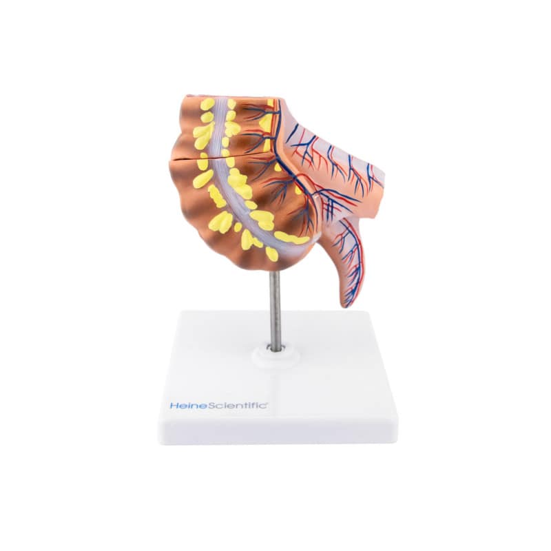 Blinddarm-Modell von HeineScientific - Anatomiemodell mit Wurmfortsatz, 17.5 cm hoch - Med-Praxisbedarf