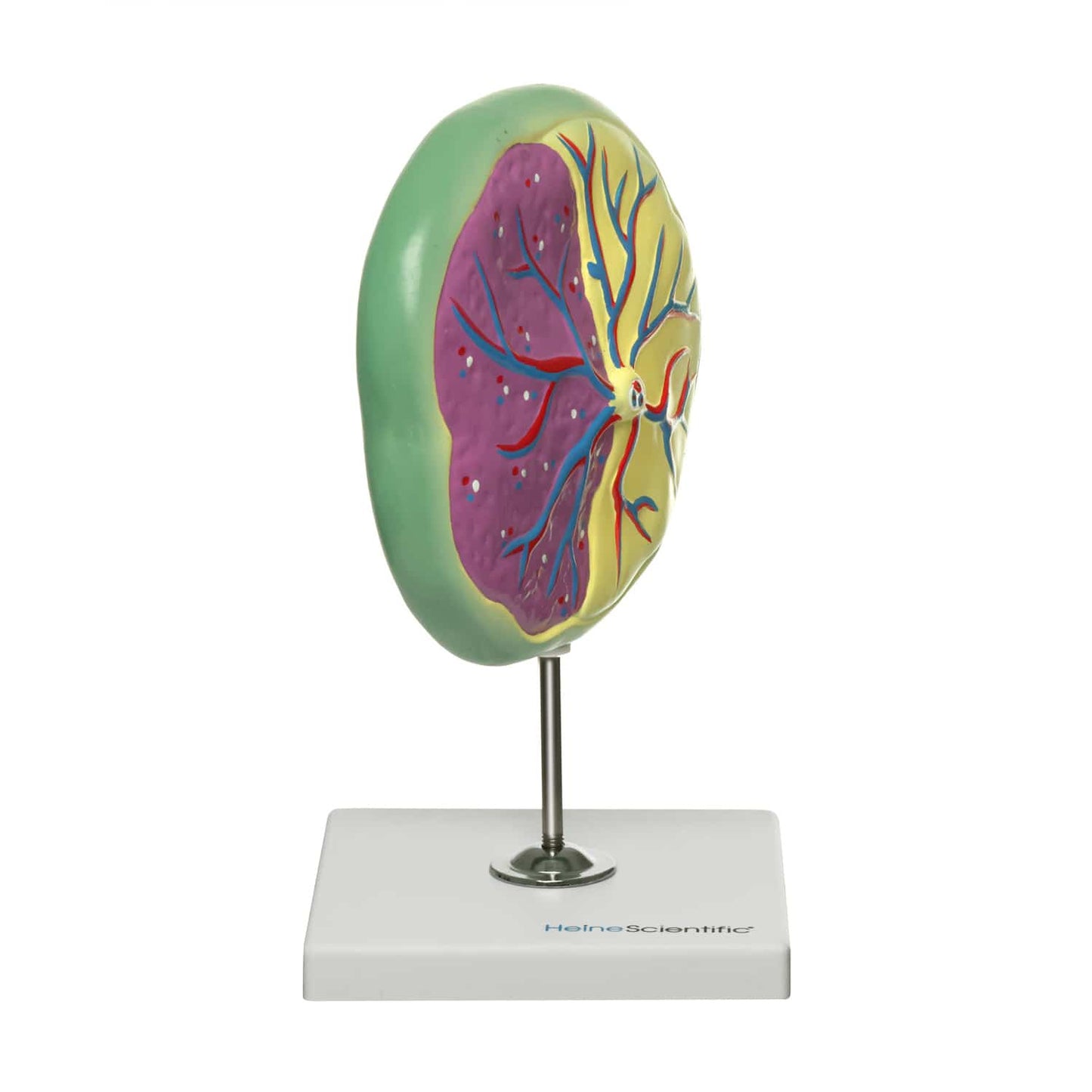 Plazenta-Modell zur Aufklärung - anatomisches Anschauungsmodell, HeineScientific - Med-Praxisbedarf