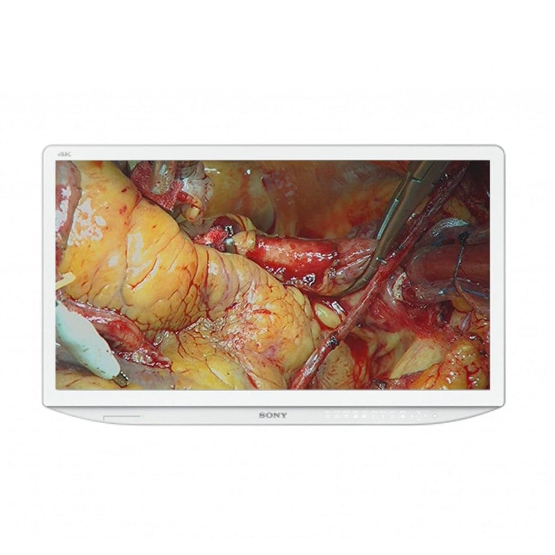 55-Zoll Medizinmonitor SONY LMD-X550MD - 4K Ultra HD für hochauflösende 2D-Videobilder - Med-Praxisbedarf