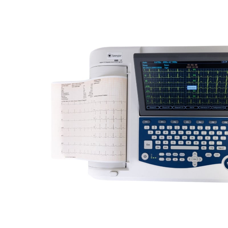 Cardiomate EKG-Gerät Frontansicht - mit Display und Bedientasten für Praxis und Klinik - Med-Praxisbedarf