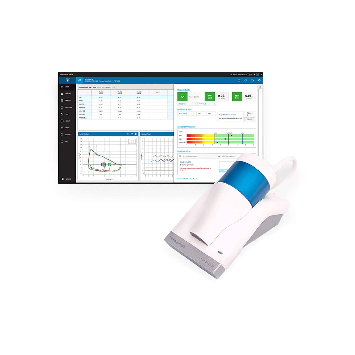 Pneumotrac Spirometer von Vitalograph - flexibles und tragbares Lungenfunktionsmessgerät - Med-Praxisbedarf
