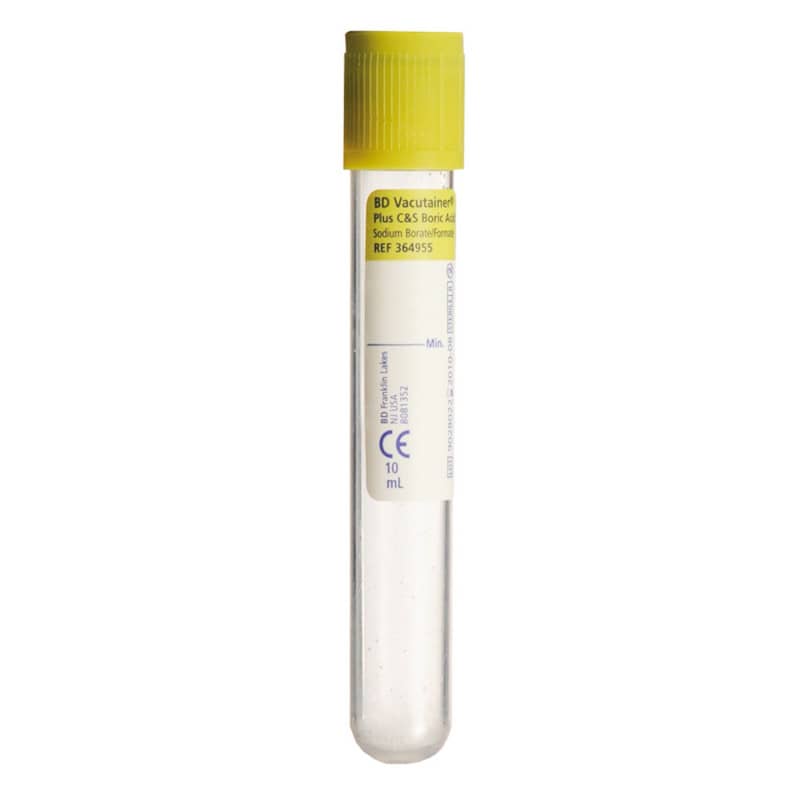 BD Vacutainer Urinröhrchen für Mikrobiologie - sterile Vakuumröhre für Kulturtests - Med-Praxisbedarf