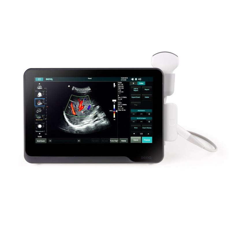 BenQ T3300 tragbares Ultraschallsystem - für Point-of-Care-Diagnostik in Praxis und Klinik - Med-Praxisbedarf