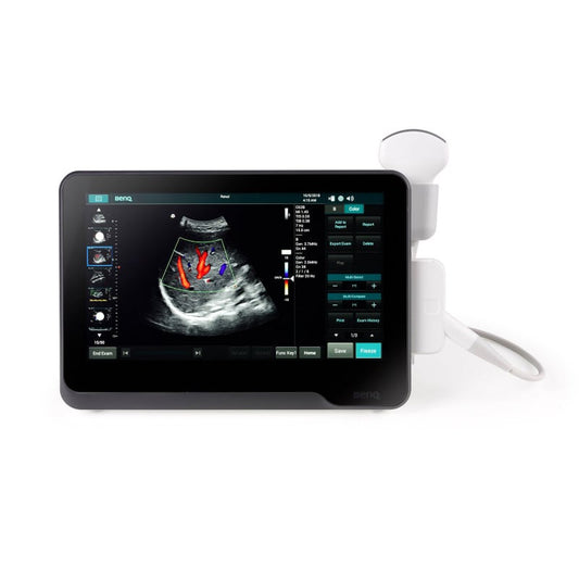 BenQ T3300 tragbares Ultraschallsystem - für Point-of-Care-Diagnostik in Praxis und Klinik - Med-Praxisbedarf
