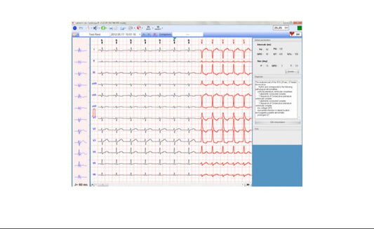 EKG-Management Software ECG-1000 für Biocare - PC-Software zur Verwaltung von Ruhe-EKG-Daten - Med-Praxisbedarf