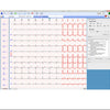 ECG-1000 EKG-Management Software für Biocare