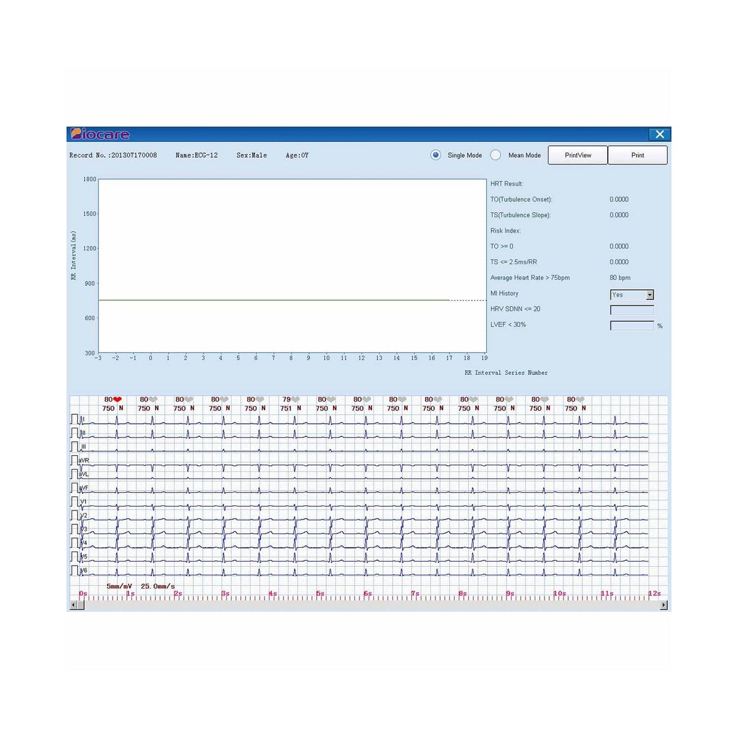 Display und Bedienfeld des ECG-2000 EKGs - Klare Anzeige der Messwerte - Med-Praxisbedarf