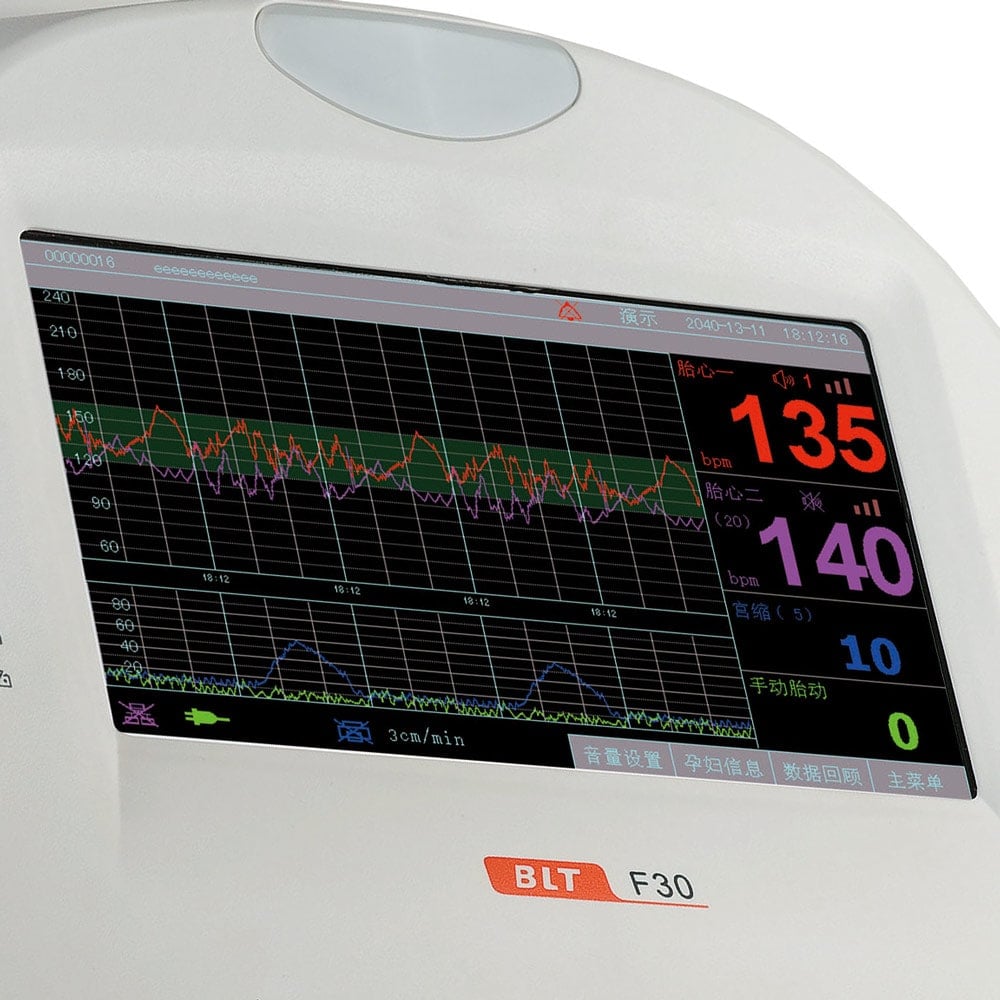 Fetalmonitor F30 Bedienung - Display mit CTG Kurven, tragbarer Fetalmonitor von Biolight - Med-Praxisbedarf
