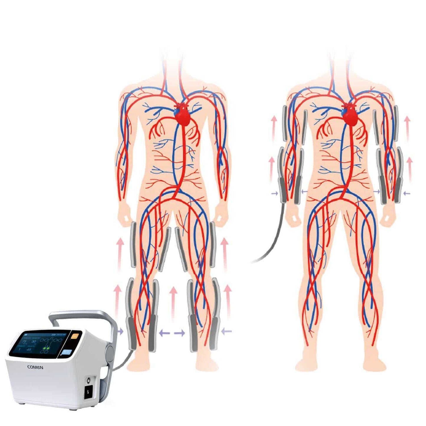 COMEN SCD600 im klinischen Einsatz - Kompressionstherapie am liegenden Patienten zur Durchblutung - Med-Praxisbedarf
