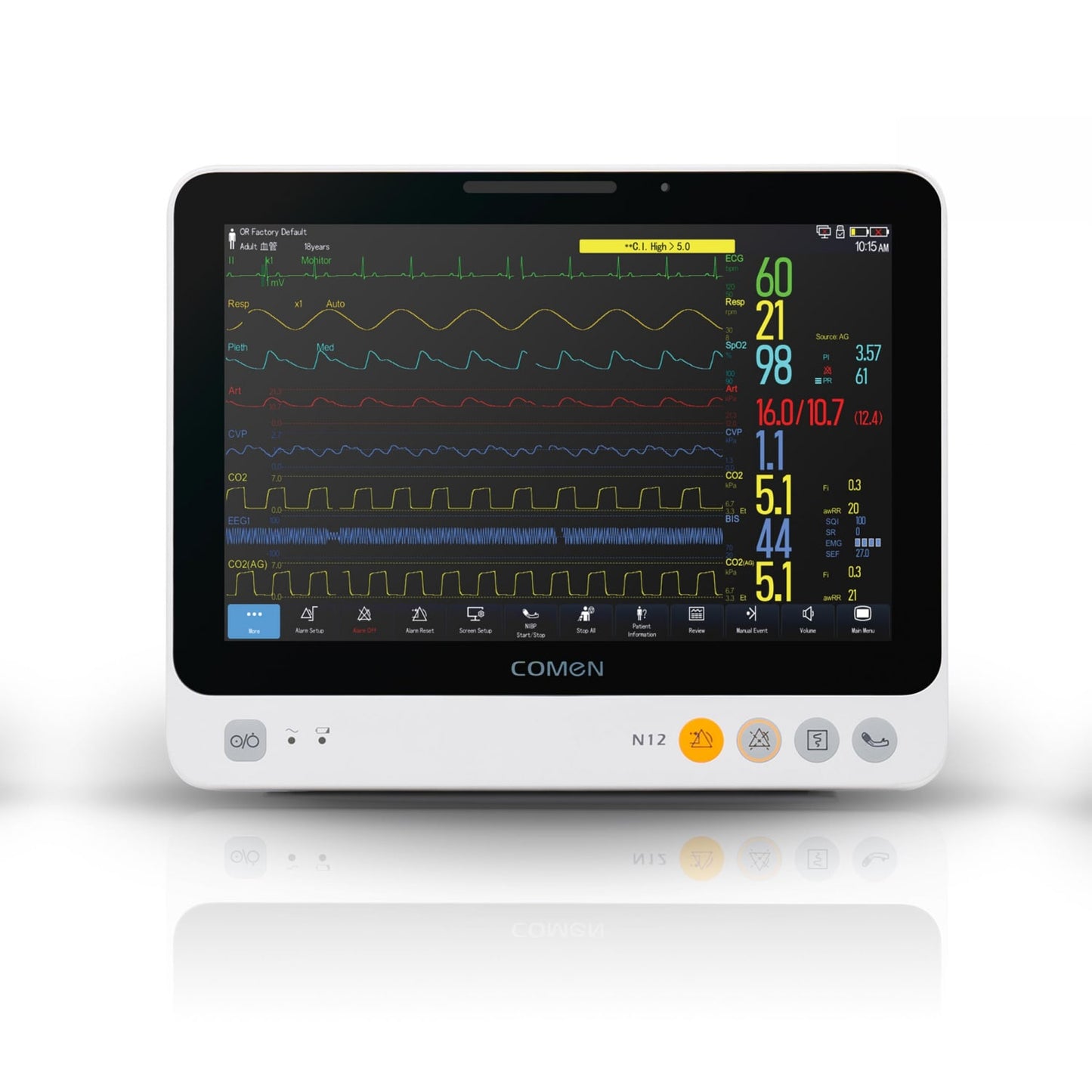 Comen N12 Monitor EKG-Überwachung - zeigt Herzfrequenz und Rhythmus auf schwarzem Bildschirm - Med-Praxisbedarf