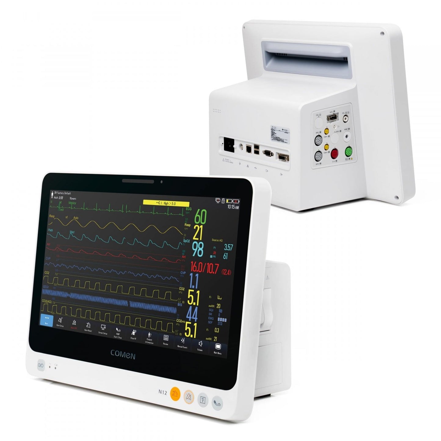 Comen N12 Patientenmonitor Seitenansicht - schlankes Gehäuse, Transportgriff und Anschlüsse im Detail - Med-Praxisbedarf