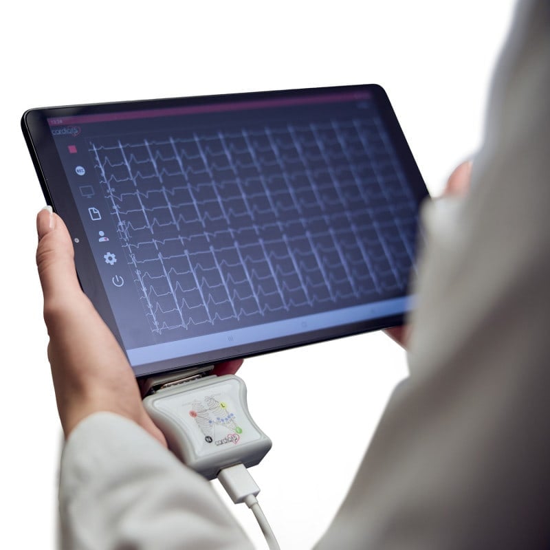 CardioNS E2 kompaktes Gehäuse - tragbares EKG-Gerät für den mobilen Einsatz - Med-Praxisbedarf