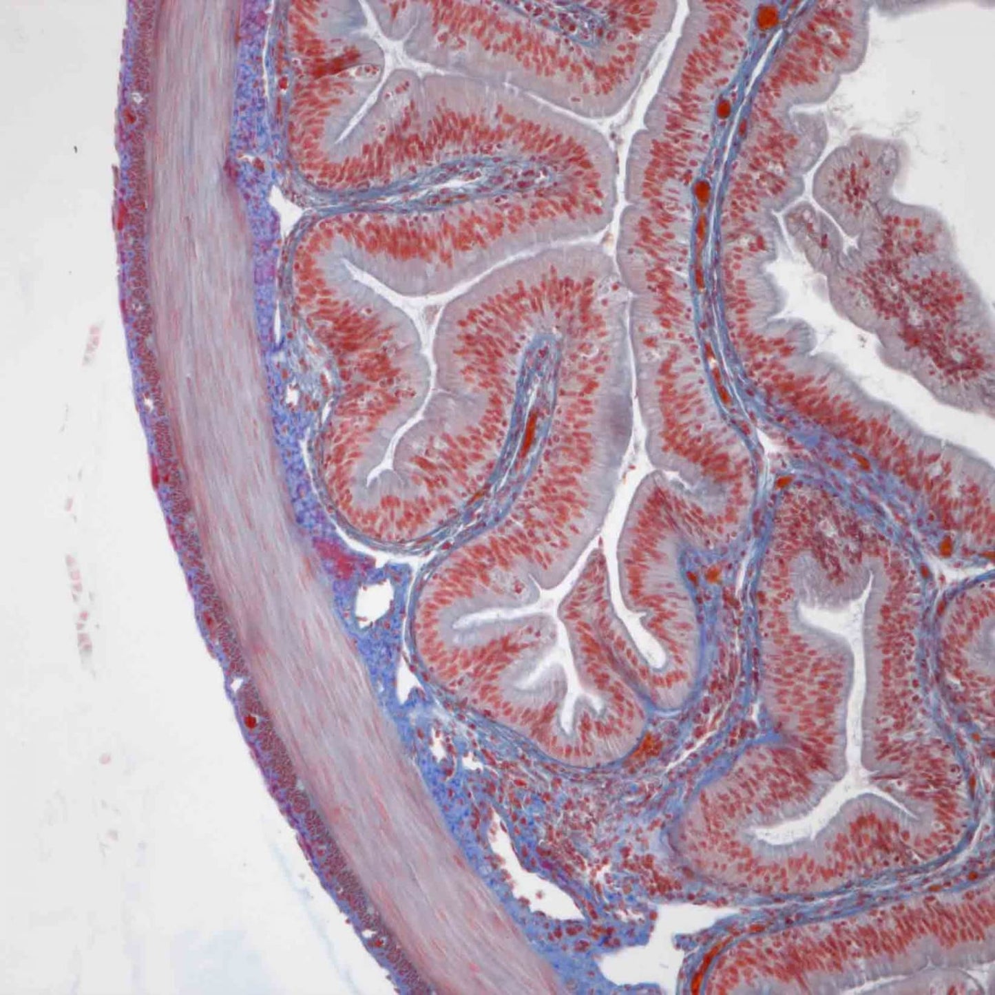Zeiss Primostar 3 Full-Köhler Labor-Mikroskop - Frontansicht mit Objektivrevolver und Tisch - Med-Praxisbedarf