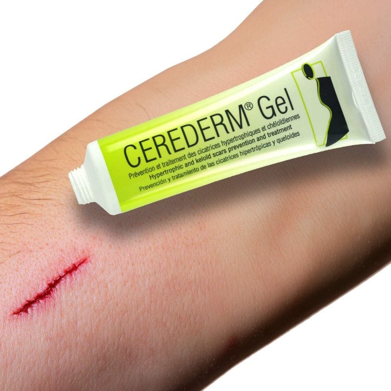 Cerederm Gel Narbenpflege Silikongel transparent - 50 g Tube für die Behandlung - Med-Praxisbedarf