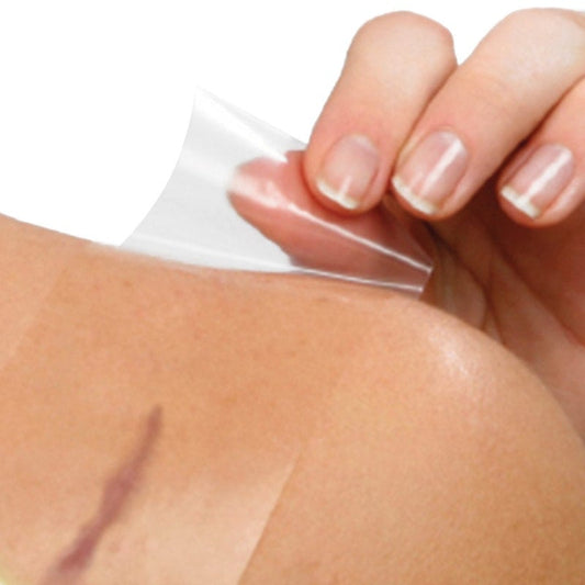 Cerederm Silikonpflaster zur Narbenbehandlung - transparent, haftend für Operationsnarben - Med-Praxisbedarf