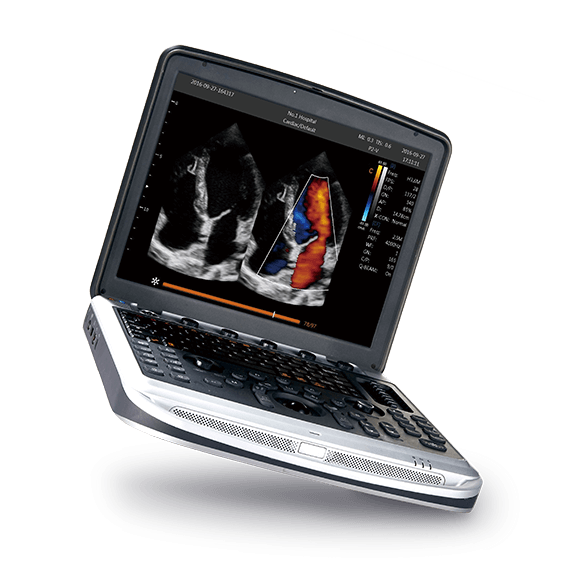 Akku für SonoBook 8 Ultraschallsystem - für Chison Geräte in Arztpraxen - Med-Praxisbedarf