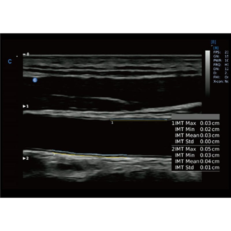 CBit6 Ultraschall Bedienoberfläche - intuitive Benutzeroberfläche und Menüführung - Med-Praxisbedarf
