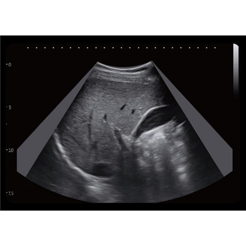 CBit6 Ultraschall Schallköpfe - verschiedene Ultraschallsonden für Untersuchungen - Med-Praxisbedarf