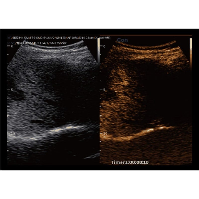 Ultraschallgerät CBit9 Farbdoppler - Bedienkonsole mit intuitiver Software und vielseitigen Schallköpfen - Med-Praxisbedarf
