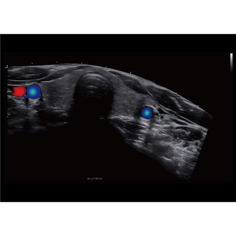 CBit9 Ultraschallsystem - mobiles Farbdoppler-Gerät auf einem rollbaren Ständer für die Praxis - Med-Praxisbedarf