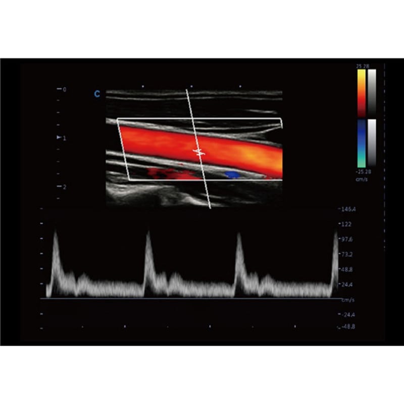 Farbdoppler-Ultraschall CBit9 - Detailaufnahme des Schallkopfanschlusses und der Geräteschnittstellen - Med-Praxisbedarf