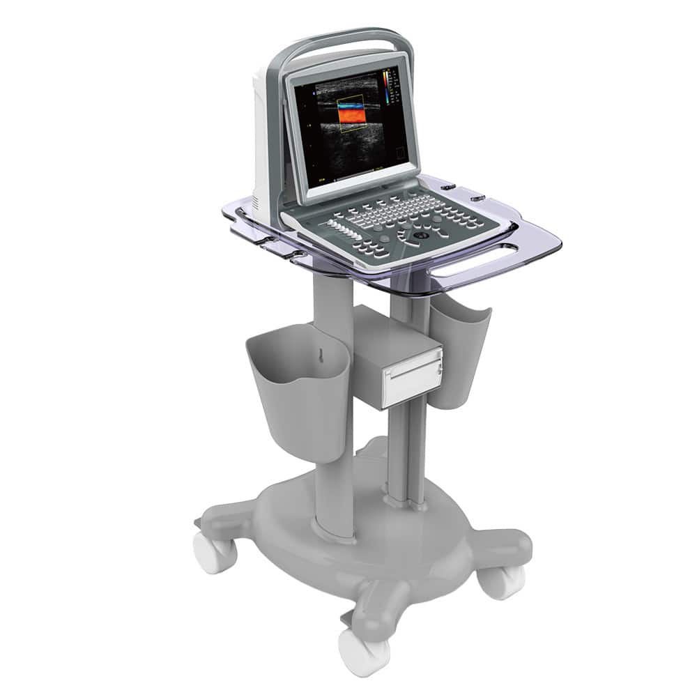 CHISON ECO5 Diagnosegerät - Ultraschallbild in hoher B-Mode Auflösung - Med-Praxisbedarf