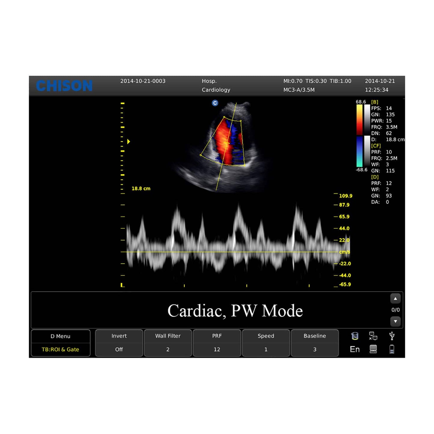 CHISON ECO5 mit Farbdoppler-Funktion - Menüsteuerung und Einstellungsoptionen - Med-Praxisbedarf