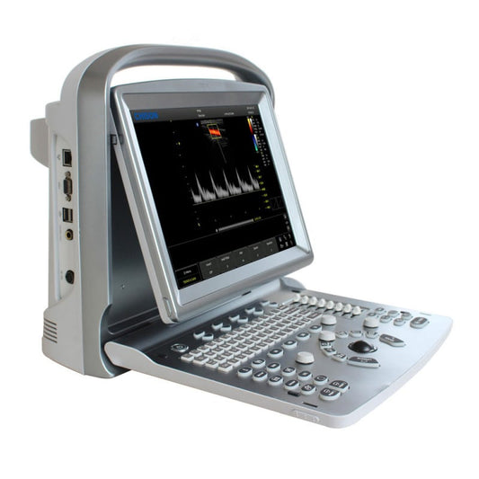 CHISON ECO5 Ultraschallgerät mit Farbdoppler - Darstellung der lebhaften Farbdoppler-Bildgebung - Med-Praxisbedarf