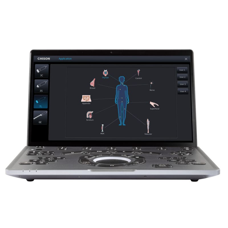 CHISON SonoAir 30 portables Farbdoppler-System - Laptop-Format, klappbarer Monitor - Med-Praxisbedarf