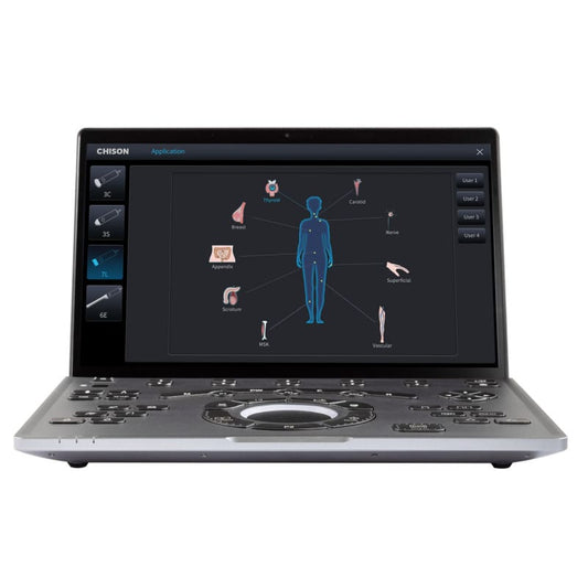CHISON SonoAir 30 portables Farbdoppler-System - Laptop-Format, klappbarer Monitor - Med-Praxisbedarf