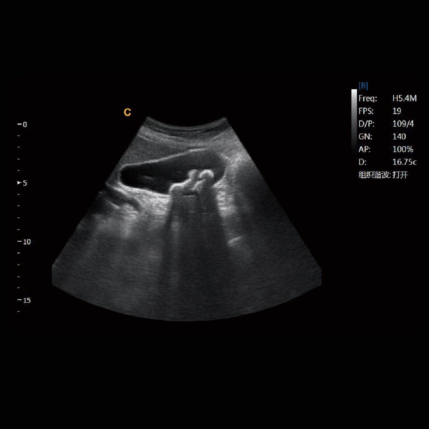 Chison EBit 30 Ultraschallsonde - Schallkopf für abdominale oder vaskuläre Diagnostik - Med-Praxisbedarf