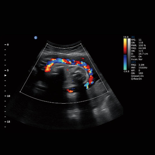 Chison EBit 30 tragbares Ultraschallgerät - 15-Zoll Farbdisplay, vielseitige Sonden - Med-Praxisbedarf