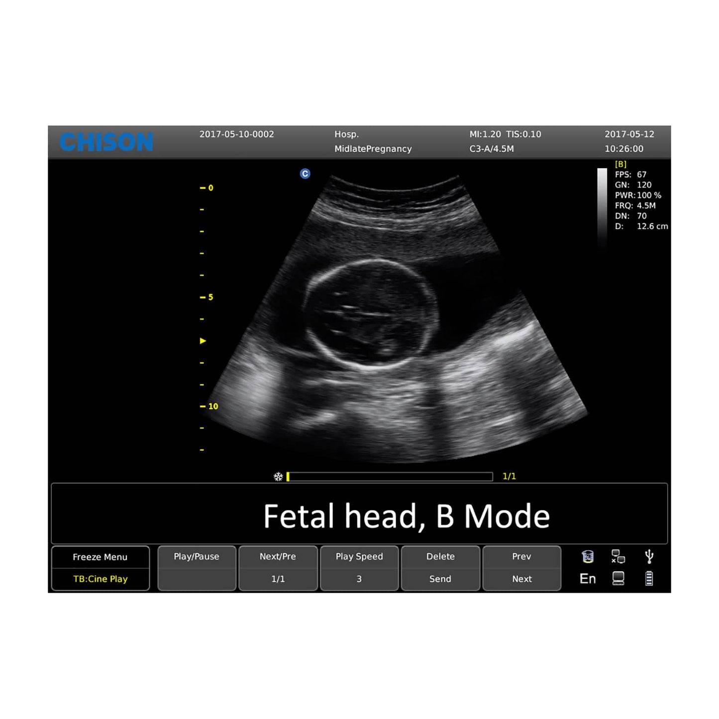 Chison ECO 6 Display - hochwertiger Bildschirm für farbkodierte Doppler-Sonografie - Med-Praxisbedarf
