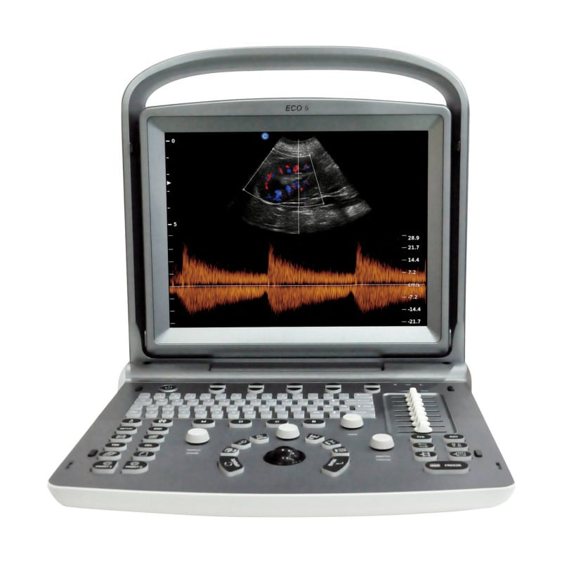 Chison ECO 6 im Einsatz - mobiles Farbdoppler-Gerät für medizinische Einrichtungen - Med-Praxisbedarf