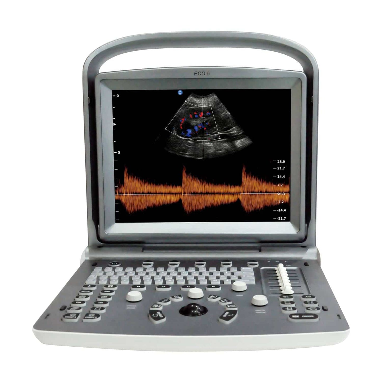 Chison ECO 6 Ultraschallgerät - tragbares Farbdopplersystem für Diagnostik in Kliniken - Med-Praxisbedarf