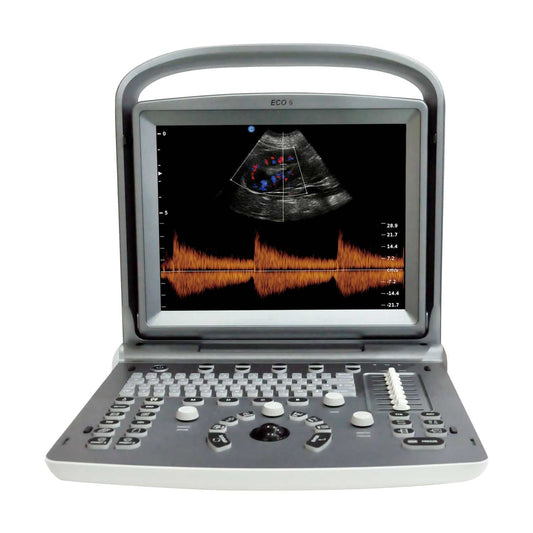 Chison ECO 6 Ultraschallgerät - tragbares Farbdopplersystem für Diagnostik in Kliniken - Med-Praxisbedarf