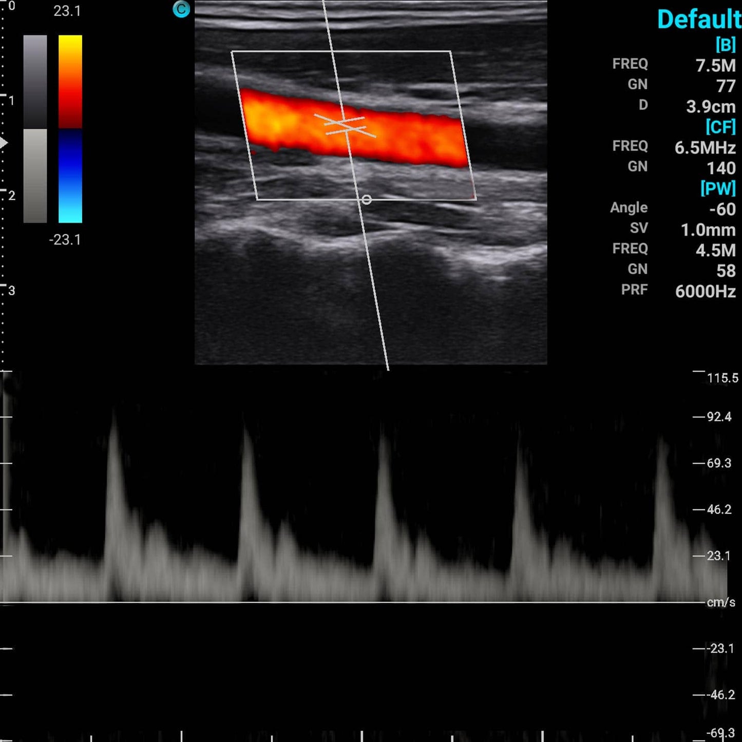 Chison SonoEye mobiles Ultraschallgerät - drahtlose Sonde, Smartphone-Anbindung, Detailaufnahme - Med-Praxisbedarf