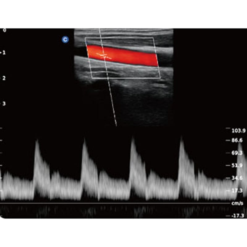 QBit5 Ultraschallgerät Bedienpanel - intuitive Tasten und Schalter - Med-Praxisbedarf