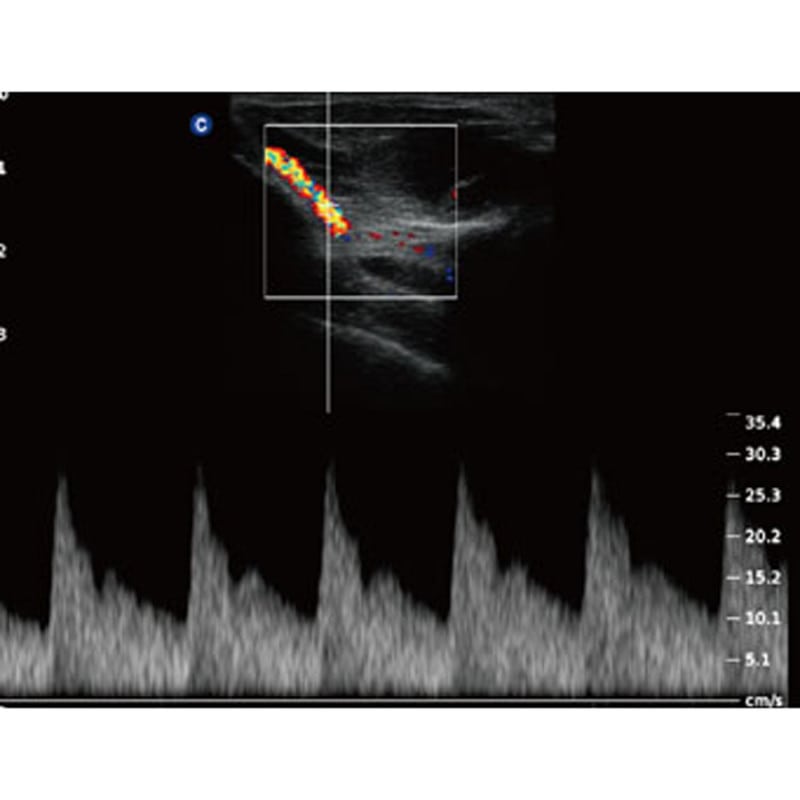 QBit5 Ultraschallgerät mit Schallkopf - für vielseitige Untersuchungen - Med-Praxisbedarf