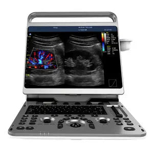 SonoAir 70 Ultra Fernsteuerung Option - Remote-Funktion für Chison Ultraschallsysteme - Med-Praxisbedarf