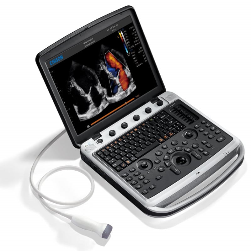 SonoBook 8 Ultraschallgerät - digitales Farbdoppler-System, tragbar, 5,4 kg - Med-Praxisbedarf