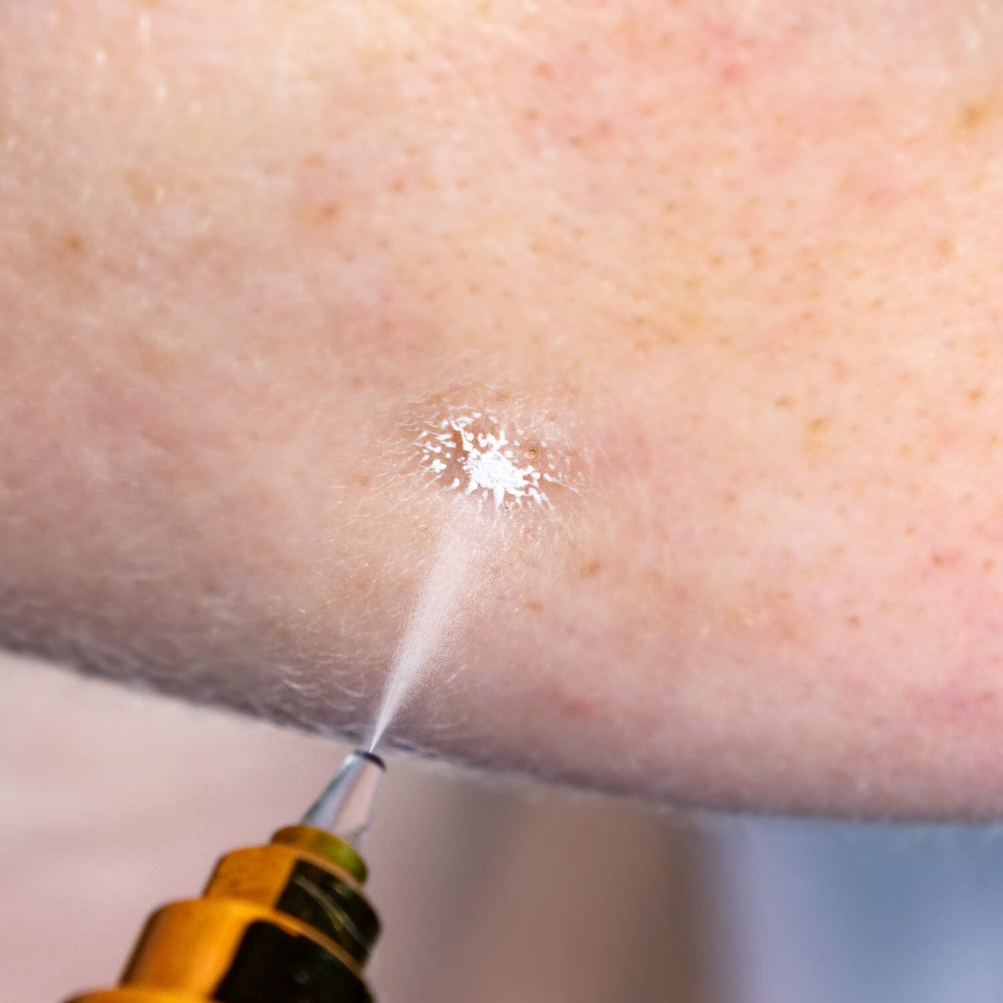 Cryoalfa SUPER technische Details - Anschlüsse, Gefriersystem - Med-Praxisbedarf