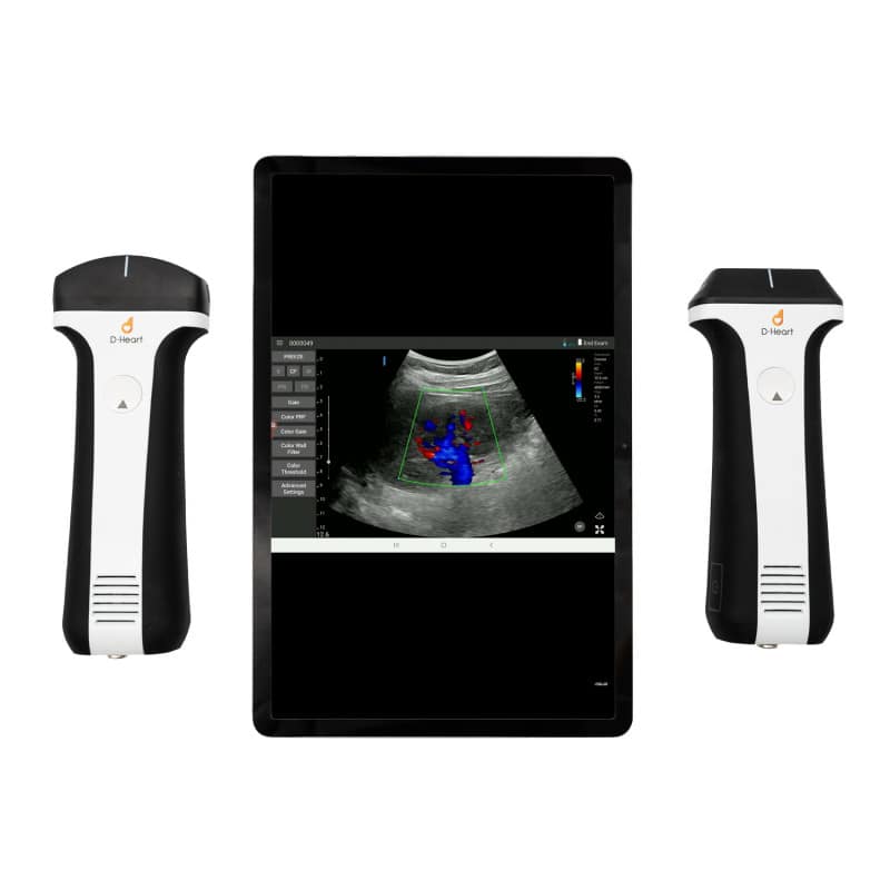 D-Heart Ultraschallgerät Komplettset - maximale Flexibilität für Klinik und Pflege - Med-Praxisbedarf
