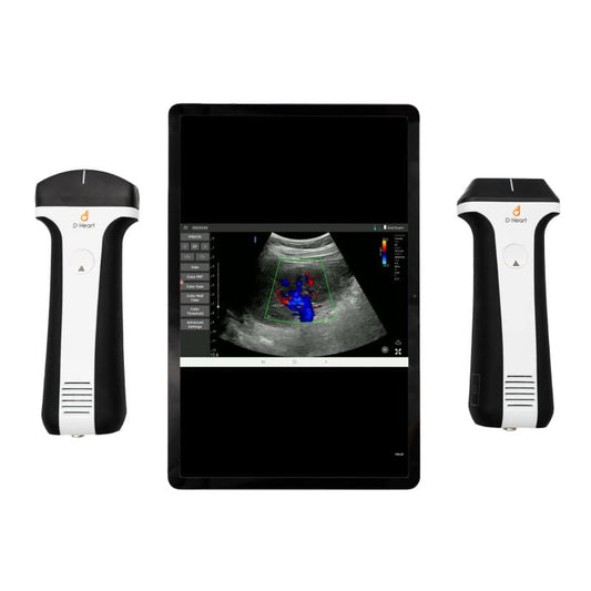 D-Heart Ultraschallgerät Komplettset - maximale Flexibilität für Klinik und Pflege - Med-Praxisbedarf