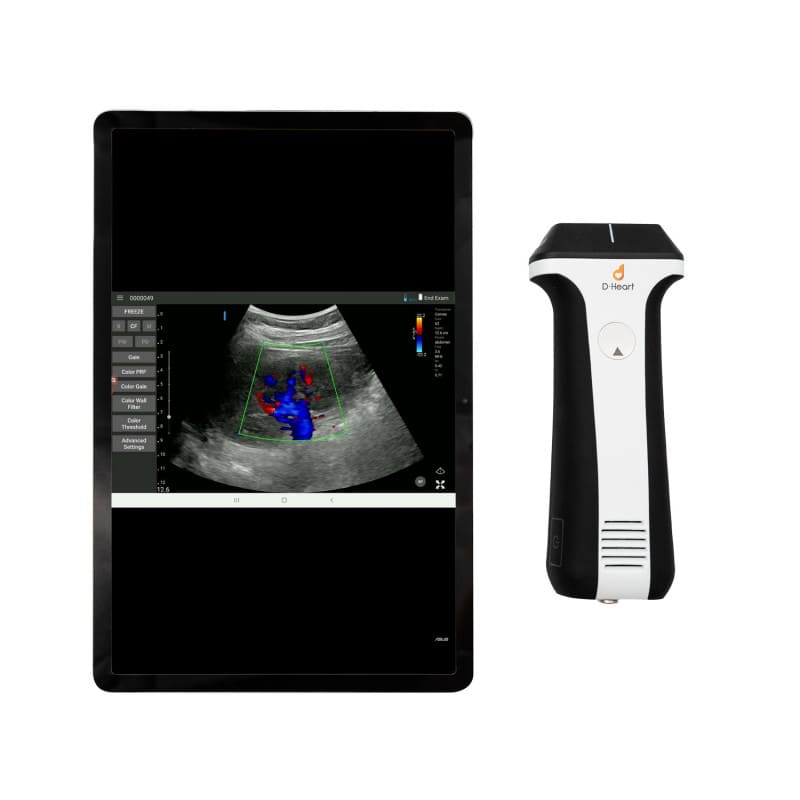 D-Heart Wireless Ultraschall - kabellose Übertragung der Untersuchungsdaten - Med-Praxisbedarf