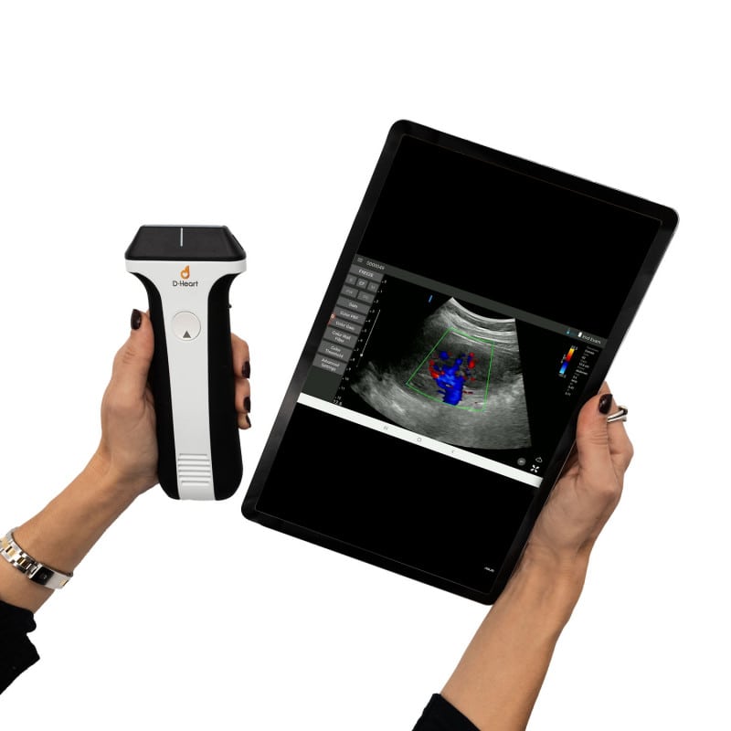 D-Heart handheld Ultraschallgerät - mobiles Ultraschallgerät für flexible Praxis-Einsätze - Med-Praxisbedarf